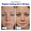 image:imageBliss Bright Idea Vitamin C Brightening Face Serum  1 Fl Oz  LongLasting01 Vitamin C Brightening  Discoloration Serum