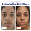 image:imageBliss Bright Idea Vitamin C Brightening Face Serum  1 Fl Oz  LongLasting01 Vitamin C Brightening  Discoloration Serum